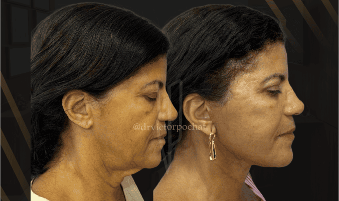 Bannervic2701262-mobi