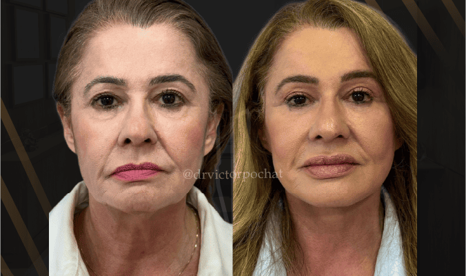 blogbannervictor2101moi