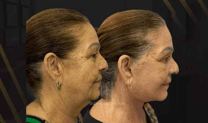 Banner mobile blog victor 120226 (1)