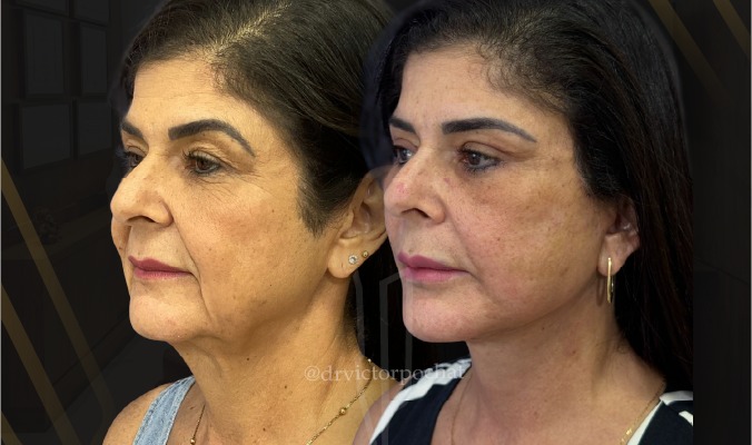 Banner130326mobilEvicbg