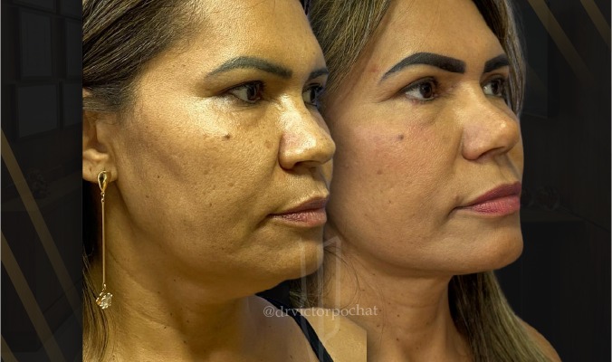 BannnerVictorDeskMobile130326