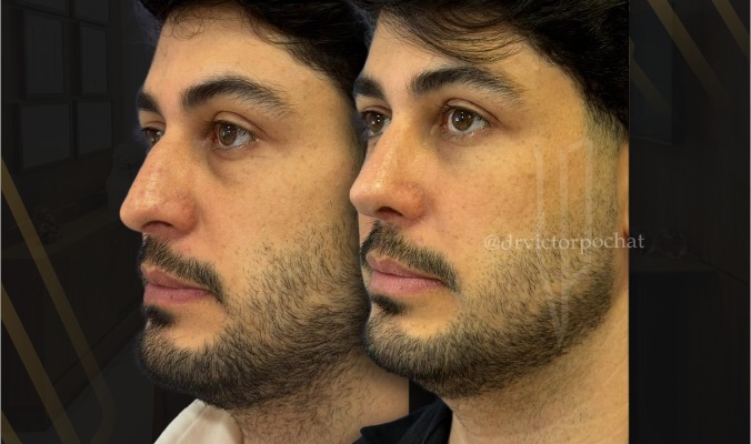 bannerblog150426mobile